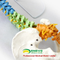 SPINE02 (12373) Medical Science Human Full Size Color Didactic Spine Model, Spine/Vertebrae Models